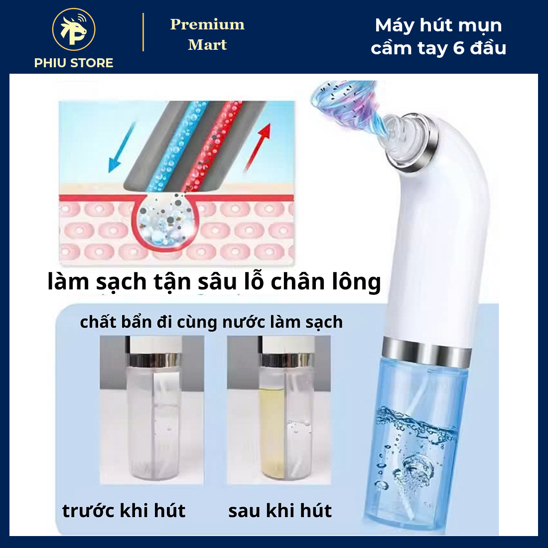 Máy Hút Mụn Cầm Tay Chân Không 3 Mức Lực Hút Kèm 6 Đầu Hút, Pin Sạc USB, Có Ngăn Chứa Dung Dịch - PHIU STORE_thumbnail_5