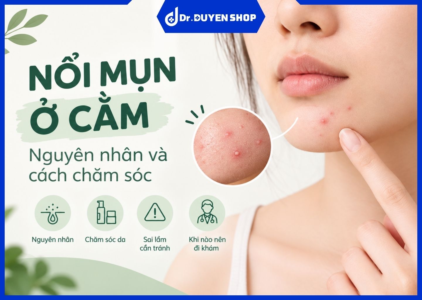 Nổi mụn ở cằm: Nguyên nhân và cách chăm sóc da
