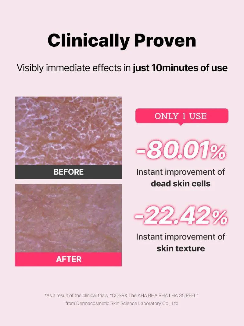 The AHA BHA PHA LHA 35% Peel_thumbnail_5