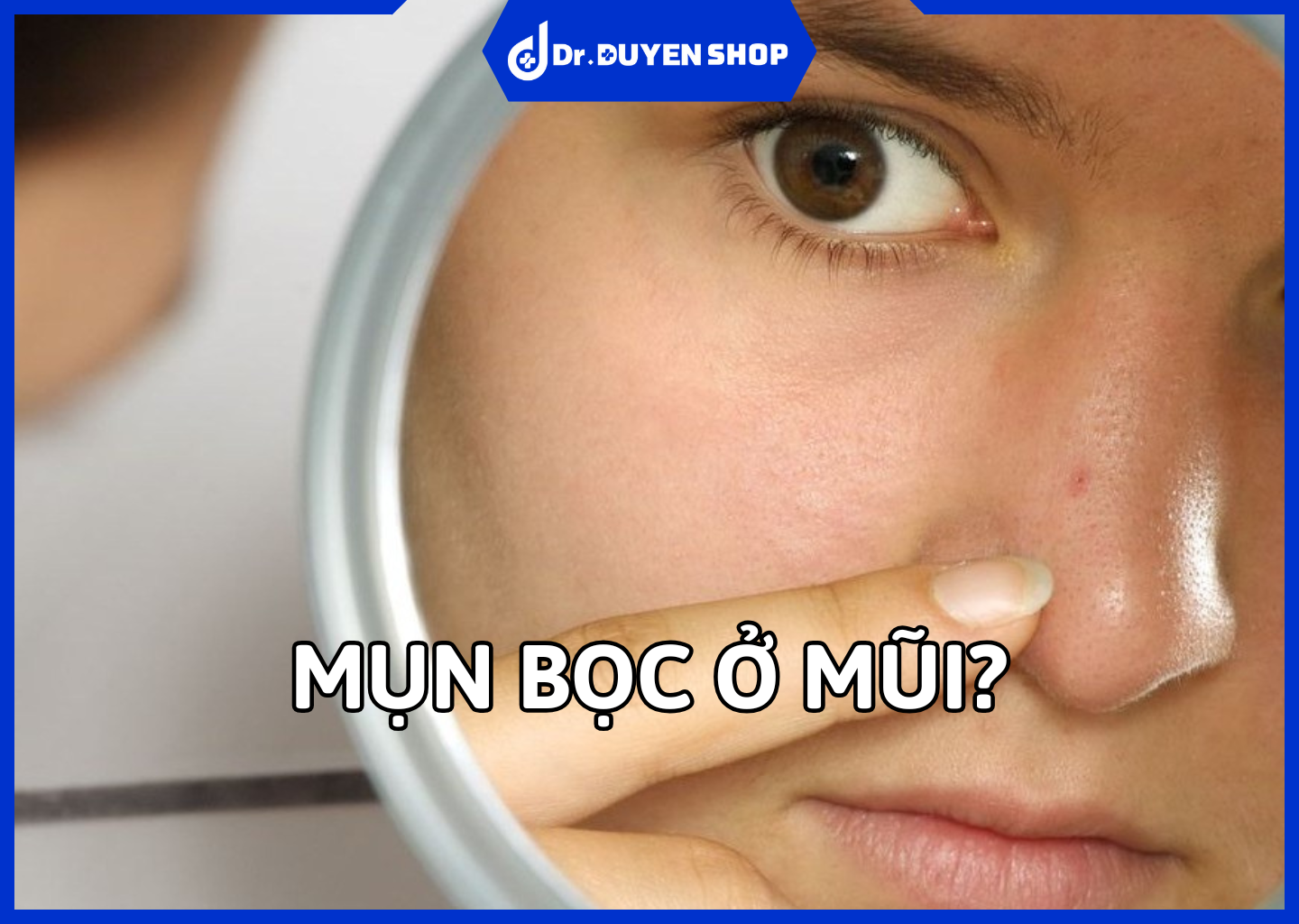 Mụn Bọc Ở Mũi – Cách Xử Lý An Toàn Và Những Sai Lầm Cần Tránh
