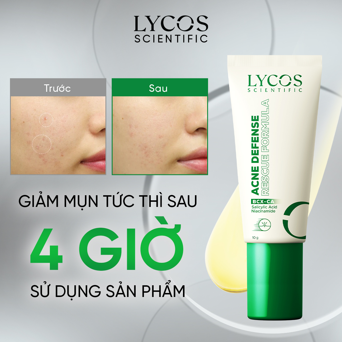 Kem Chấm Mụn LYCOS Acne Defense Rescue Formula Hỗ Trợ Làm Khô Cồi, Làm Dịu Và Chăm Sóc Vùng Da Mụn10g_thumbnail_21
