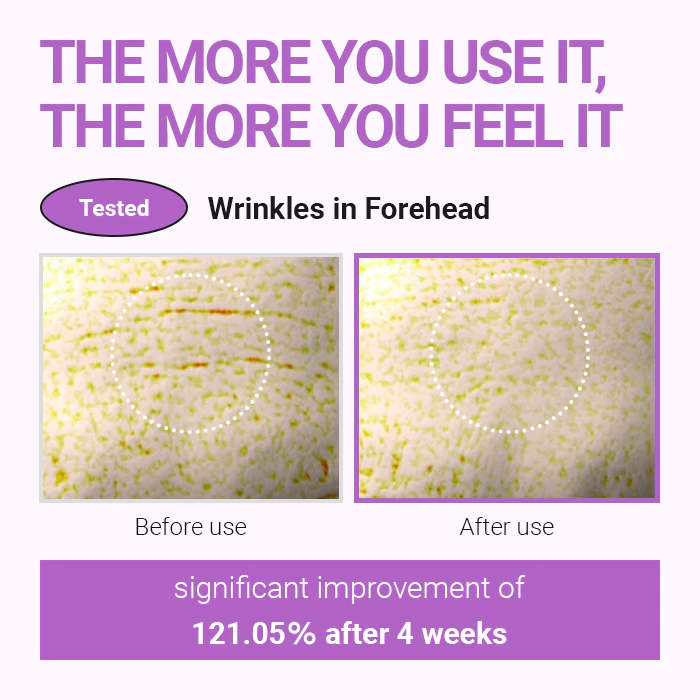 Isntree Hyper Retinol Ex 1.0 Serum 20ml_thumbnail_5