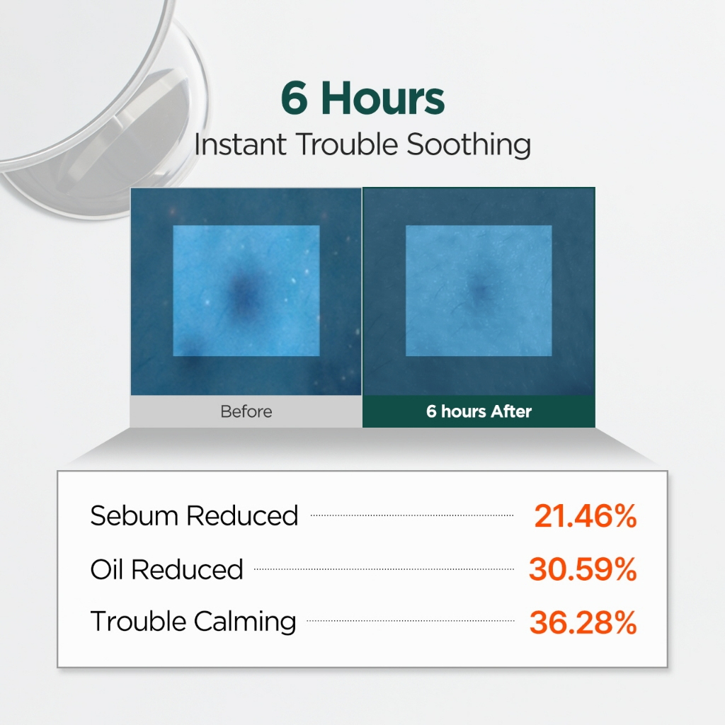 P.Calm Centella Trouble Spot 15ml_thumbnail_5