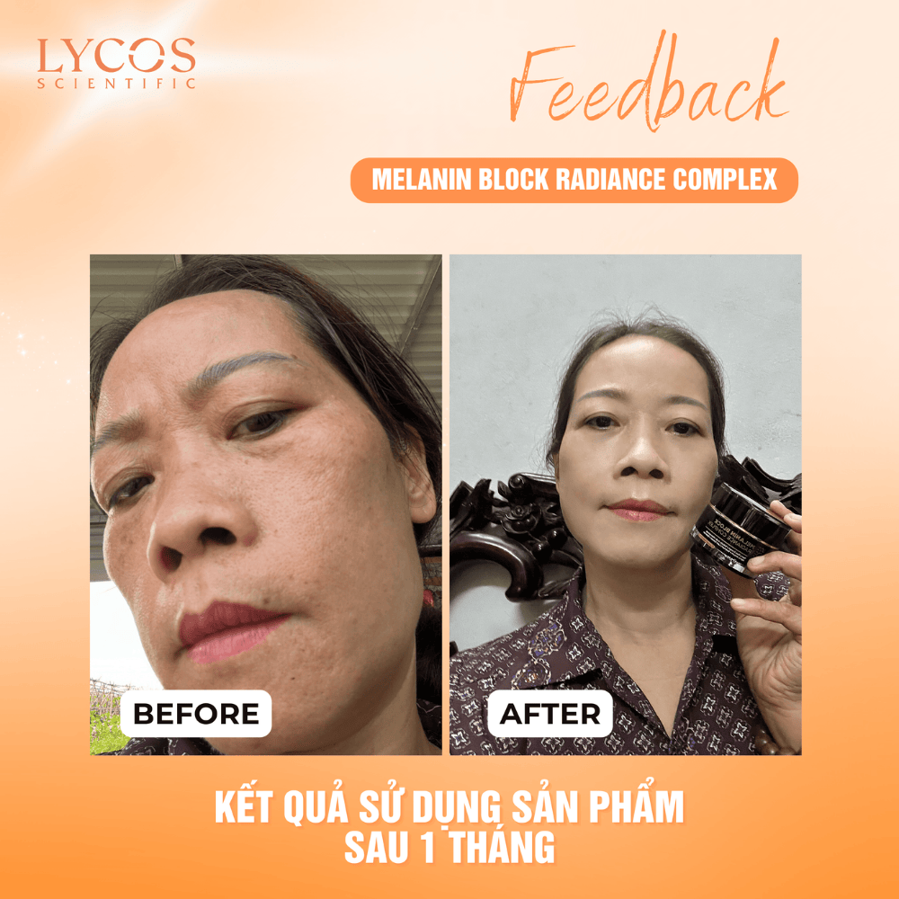 Combo Cải Thiện Nám Lycos – Peel Da AHA BHA + Kem Nám Đêm – Làm Đều Màu, Hỗ Trợ Làm Mờ Thâm Nám_thumbnail_8