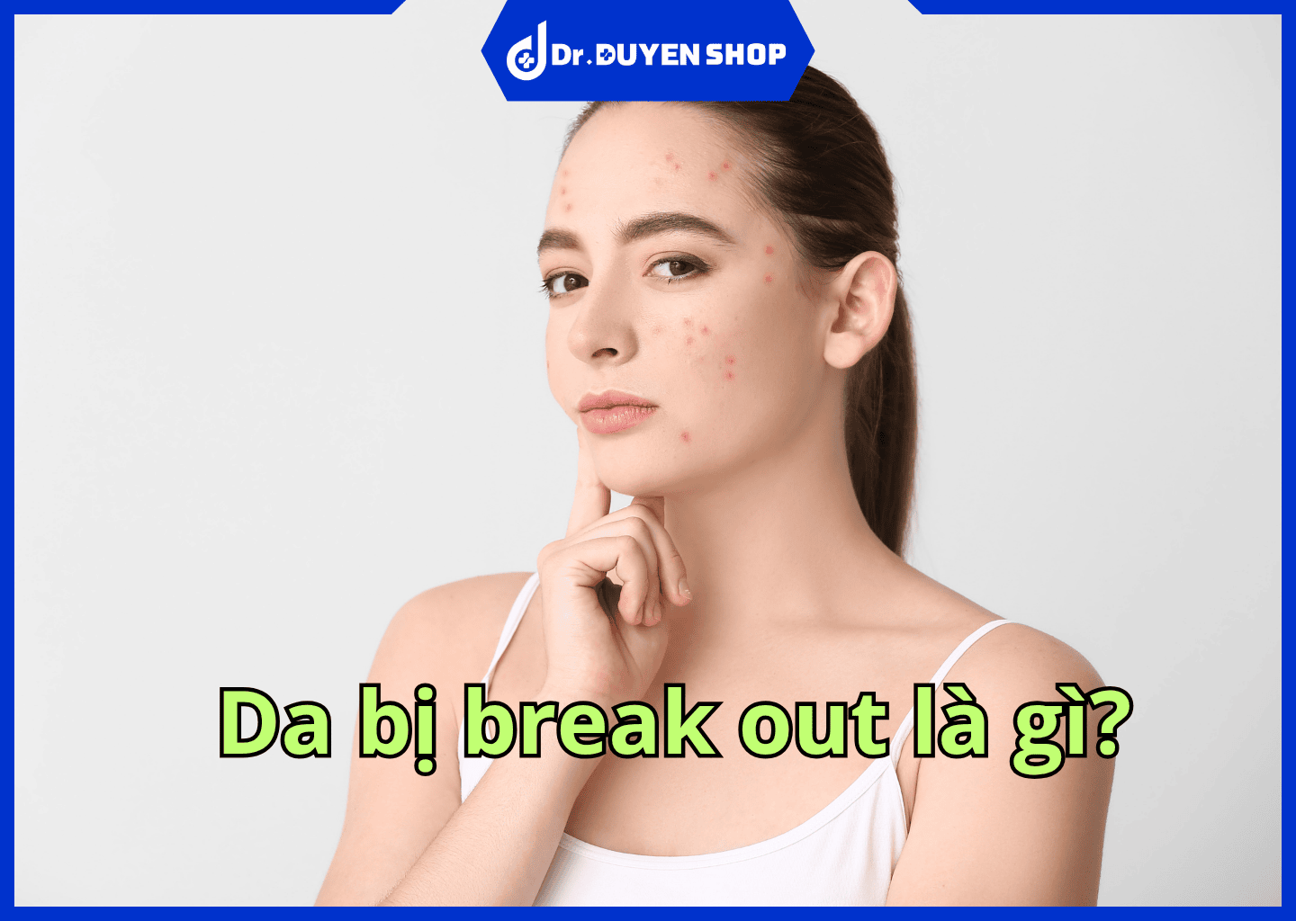 Da bị break out là gì? Nguyên nhân và cách chăm sóc cho da break out