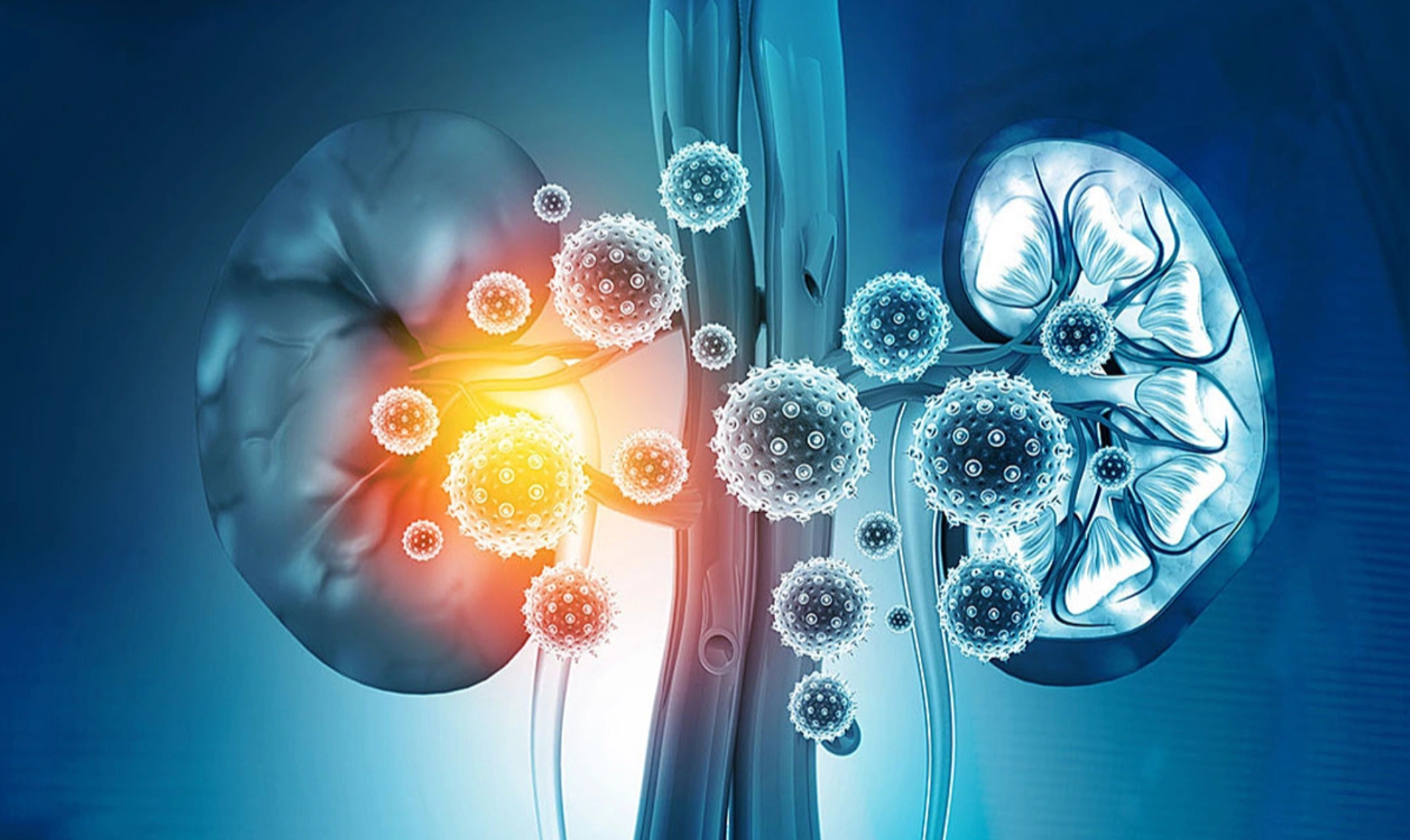 Hành trình vượt qua suy thận mạn tính