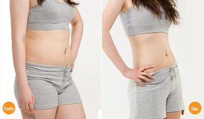 truoc-sau-giam-can-1