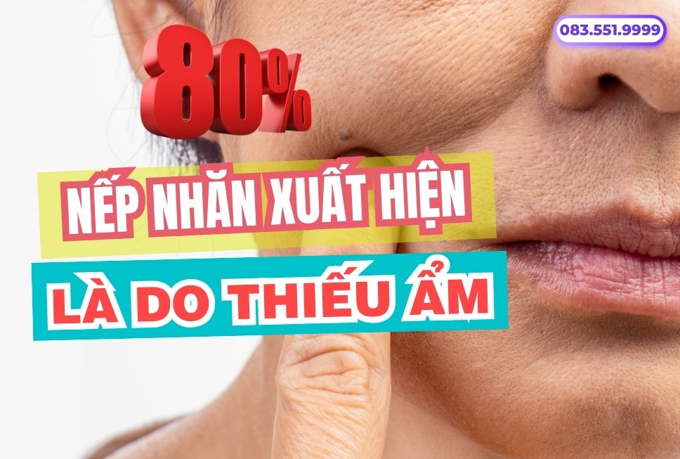 Các chị có biết 80% nếp nhăn xuất hiện do thiếu ẩm?