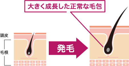 Thuốc bôi mọc tóc nữ_thumbnail_3