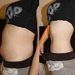 truoc-sau-giam-can-6