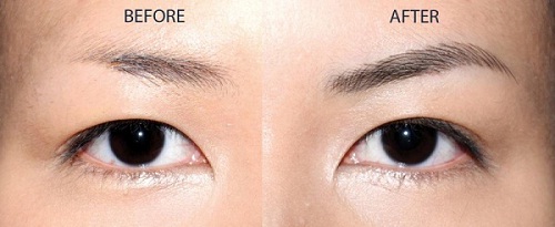 Snor Thailand Advanced Growth Serum: Hair, Beard & Brows_thumbnail_3