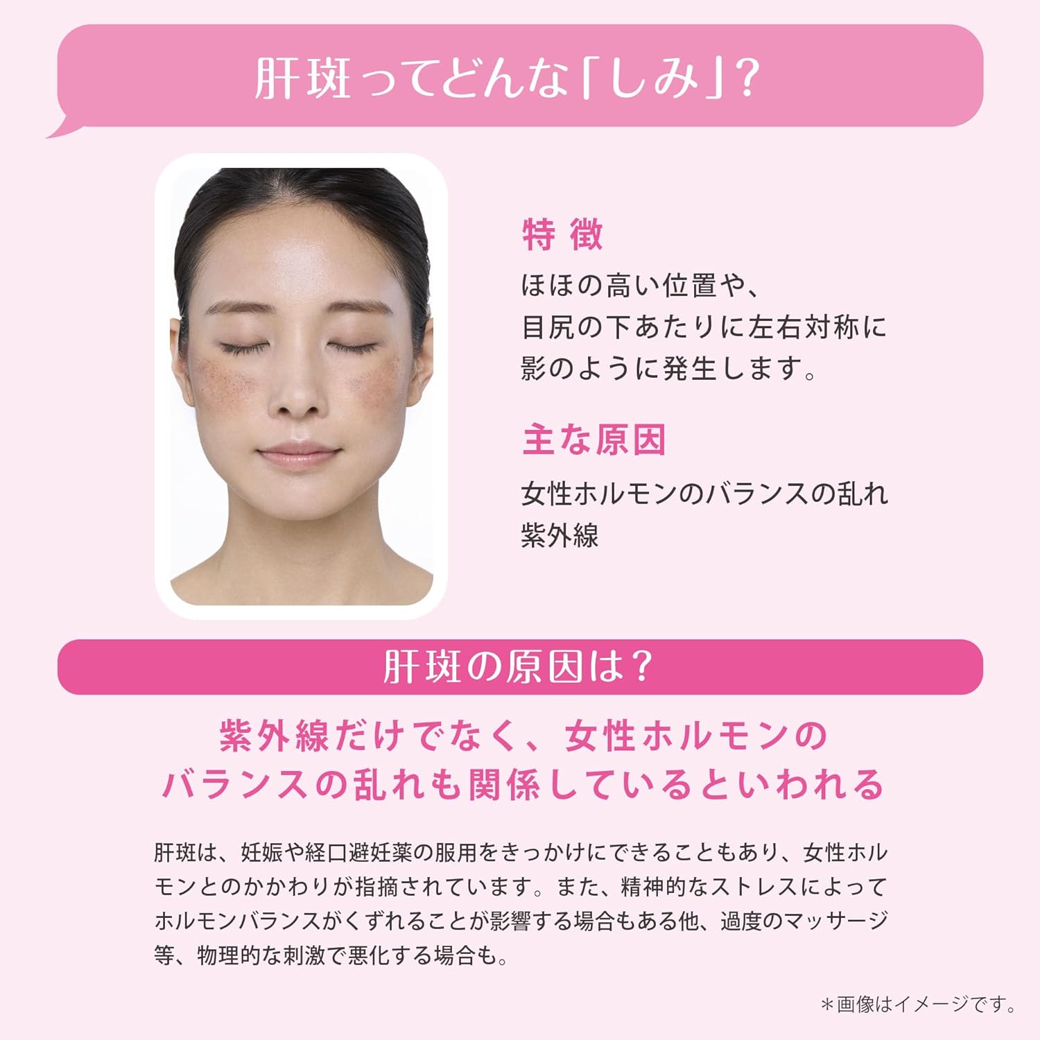 Viên uống trị nám Transino EX_thumbnail_3