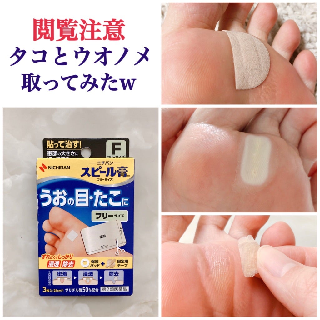 Miếng dán mụn cóc