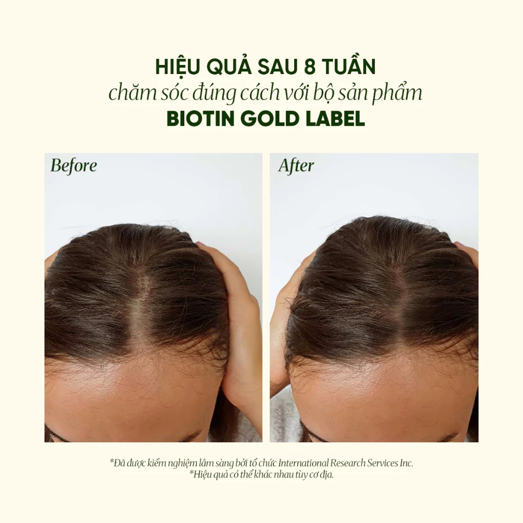 Dầu Gội Biotin Pura D'or Original Gold Label Giảm Rụng Tóc, Hỗ Trợ Mọc Tóc 473ml_thumbnail_7