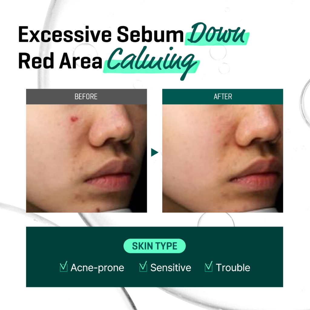 Some By Mi AHA.BHA.PHA 30 Days Miracle Serum 50ml_thumbnail_5