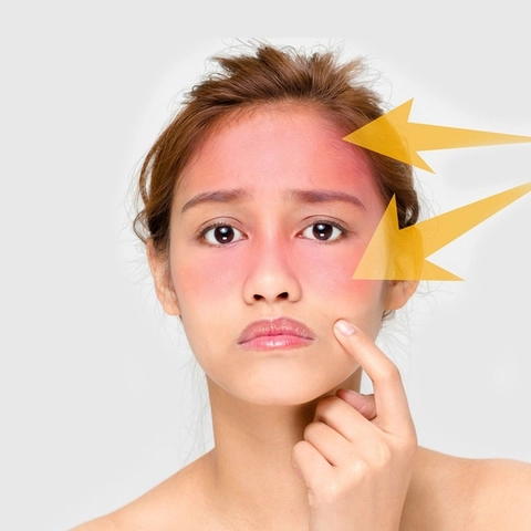 Những tác hại của tia cực tím mọi người không nên xem nhẹ