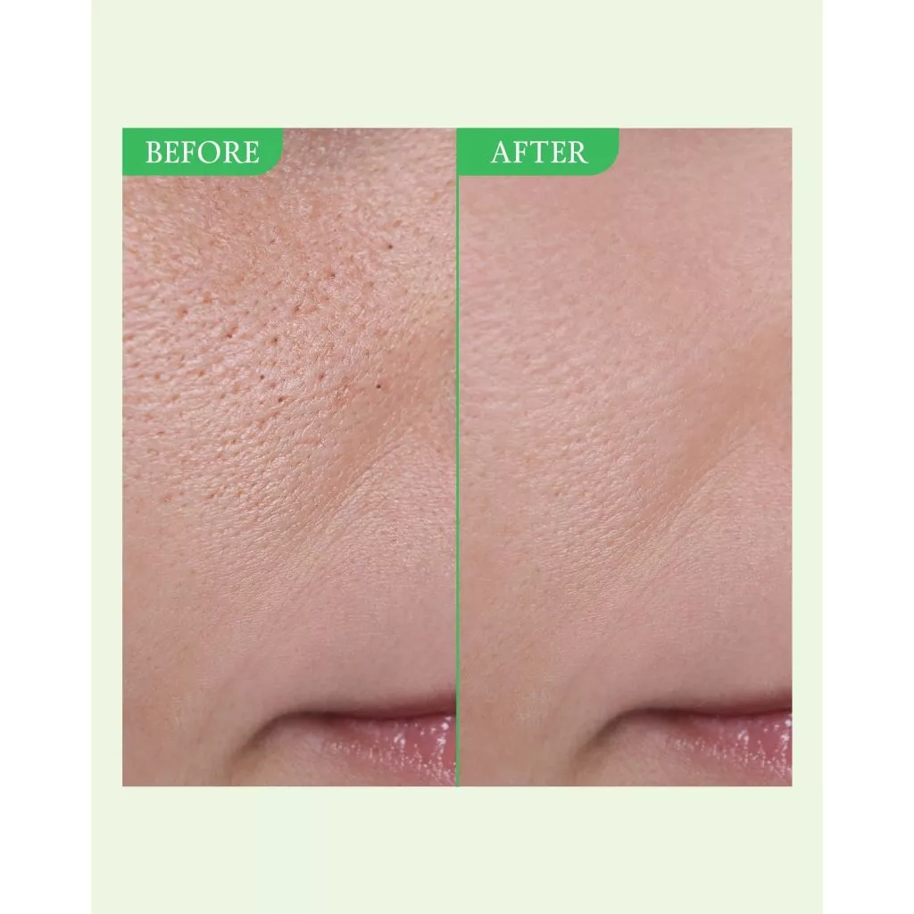 Green Tomato Serum 30ml_thumbnail_3