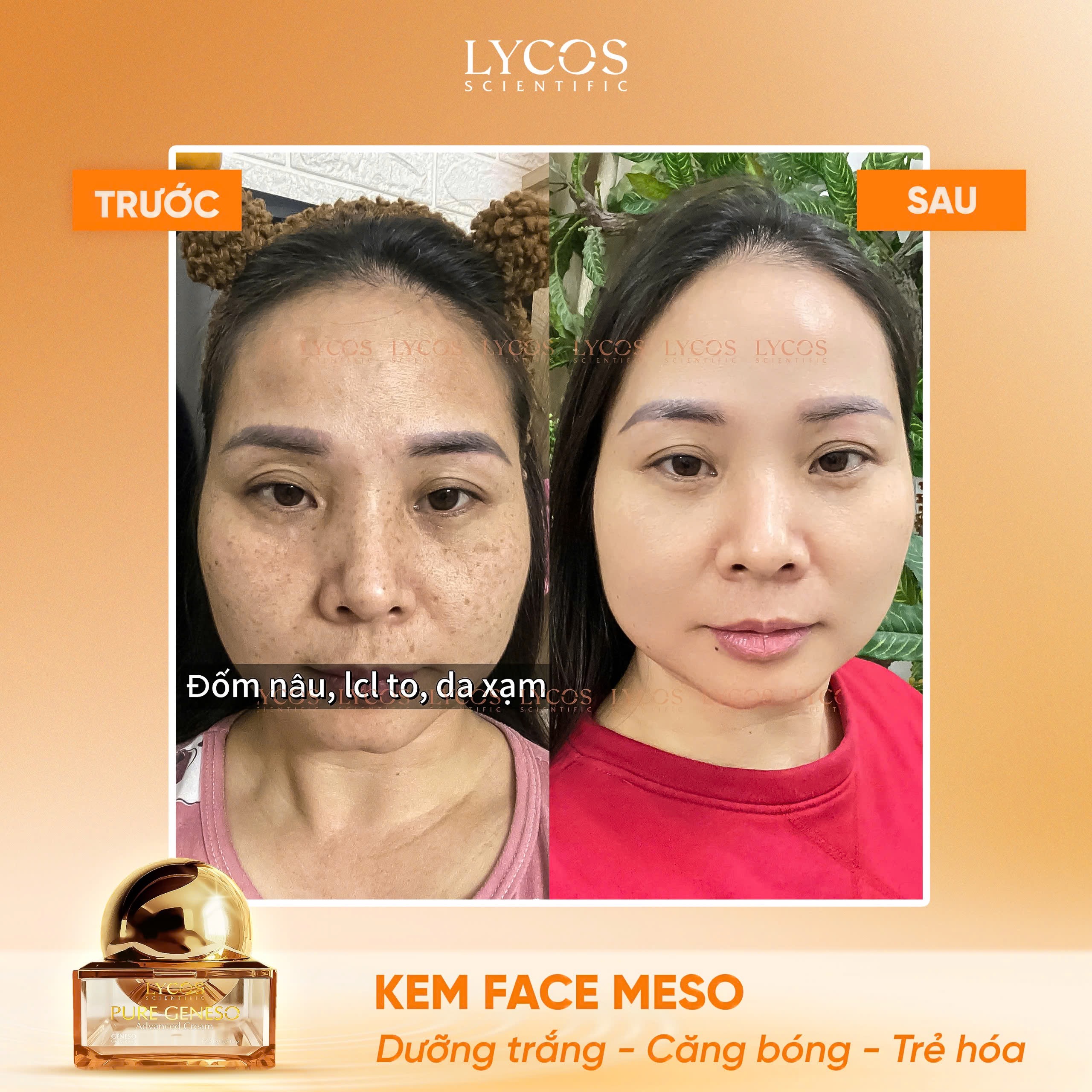 [MUA 1 ĐƯỢC 2] Kem Face Meso LYCOS Dưỡng Trắng, Căng Bóng & Dưỡng Da Mềm Mịn 20g – Tặng 1 Serum Cốt Hoa_thumbnail_8