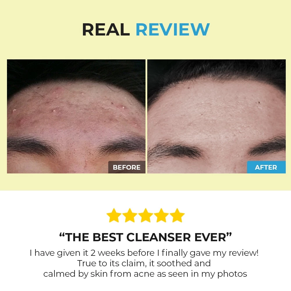 COSRX Low pH Good Morning Gel Cleanser_thumbnail_4