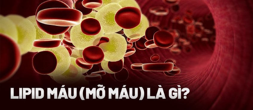 MỠ MÁU CAO: CÓ NGUY HIỂM KHÔNG, NGUYÊN NHÂN, TRIỆU CHỨNG, ĐIỀU TRỊ