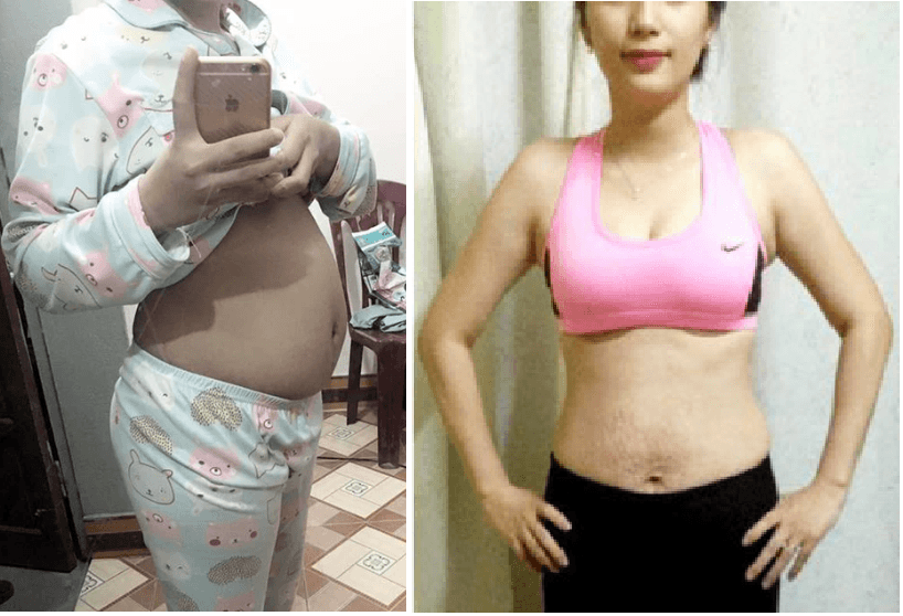 truoc-sau-giam-can-1-1