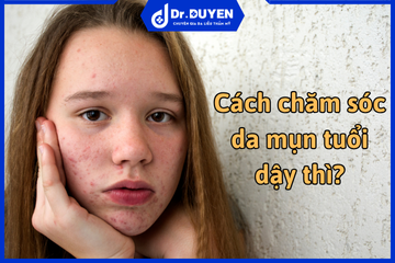 Cách chăm sóc da mụn tuổi dậy thì đúng cách và hiệu quả nhất