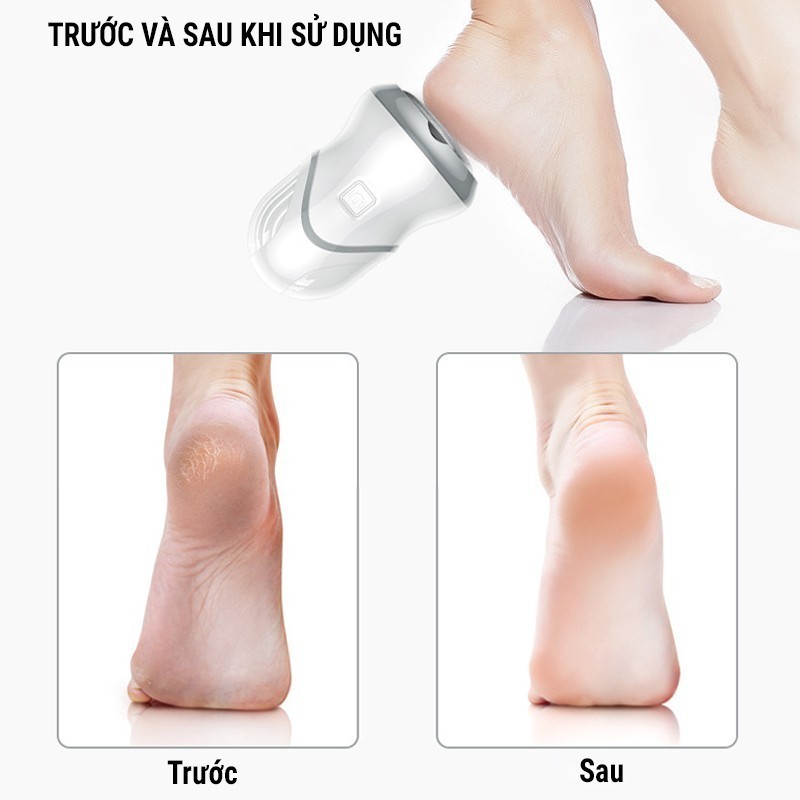 Máy Chà Gót Chân NMIMART Tẩy Tế Bào Chết Tự Động, 3 Đầu Mài Đa Dụng MCG01_thumbnail_5