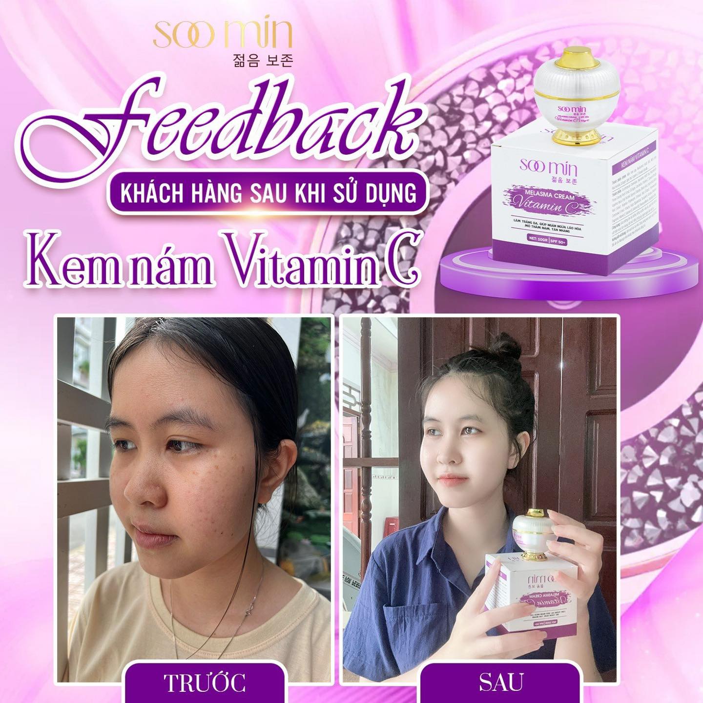 Kem Nám Vitamin C SooMin – Cứu Tinh Cho Làn Da Nám Sạm, Sáng Mịn Tự Nhiên_thumbnail_10