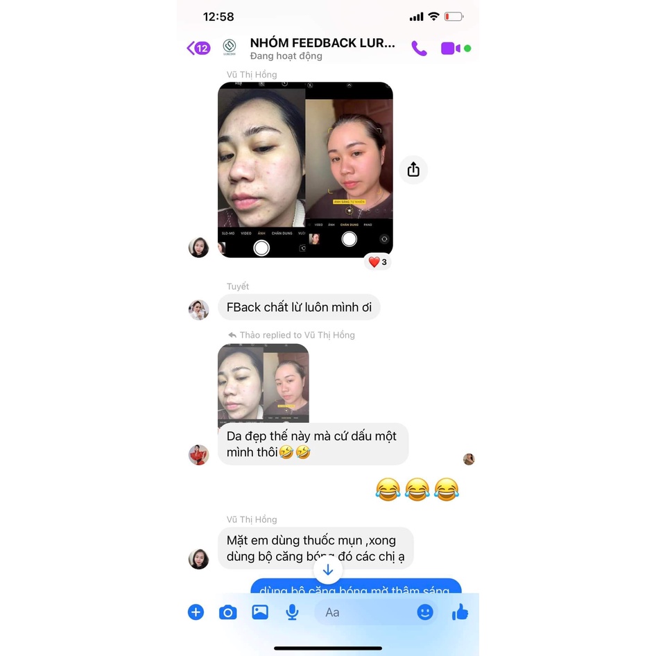 Serum Chăm Sóc Da Mụn Mờ Thâm LURCINN SAPANZI Prevent Acne 10ml_thumbnail_8