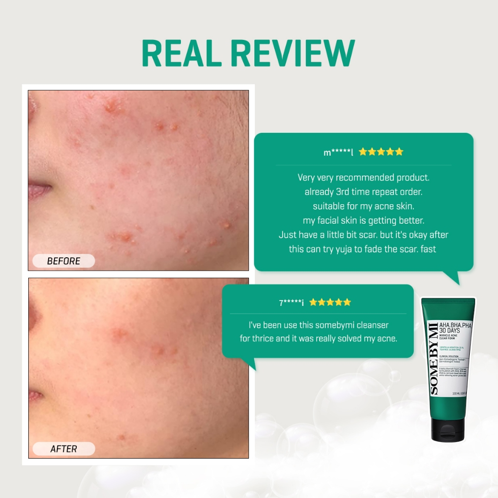 SOME BY MI Salicylic Acid 30 Days Miracle Acne Clear Foam_thumbnail_4