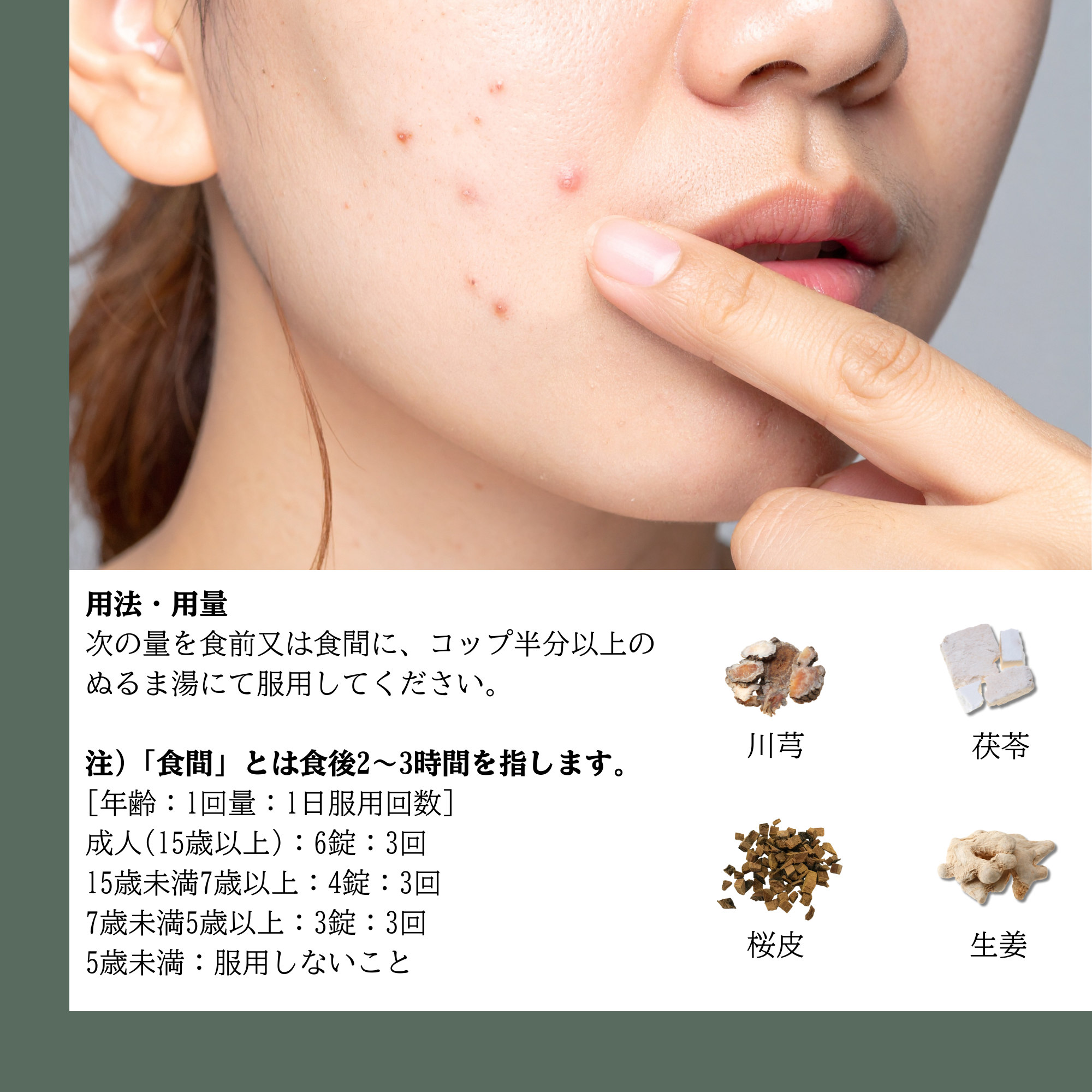 Kanpo 205 - Trị mụn viêm, mụn mủ, giải độc, thanh nhiệt_thumbnail_3