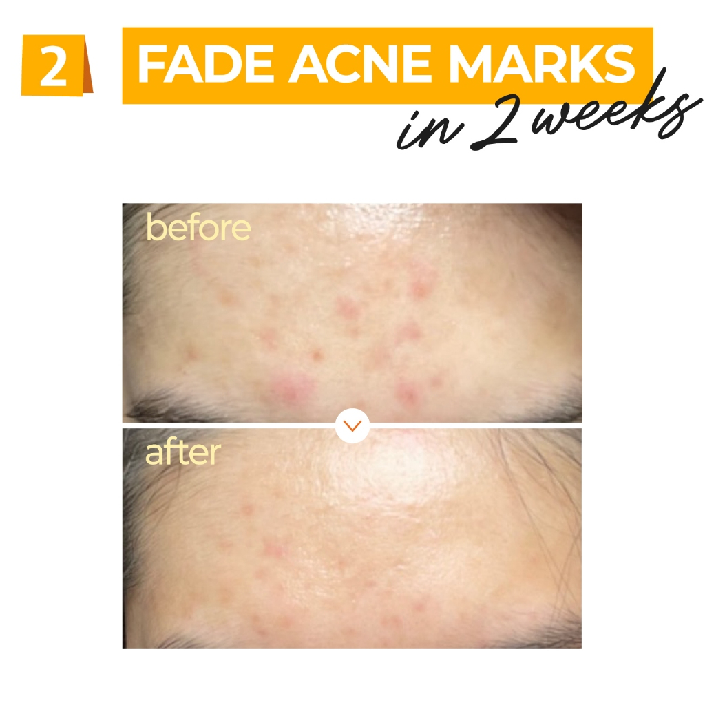 Numbuzin No.5+ Vitamin Concentrated Serum 30ml_thumbnail_6