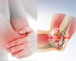 Viêm Gân – Nguyên nhân, triệu chứng và cách điều trị hiện đại_thumbnail_1