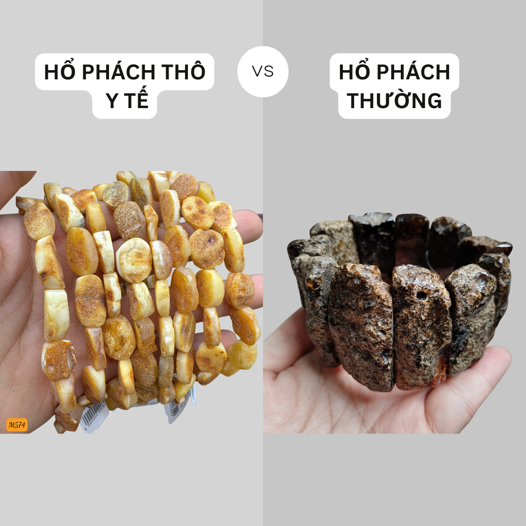 Sự Khác Nhau Giữa Hổ Phách Thô Y Tế Và Hổ Phách Thô Thường