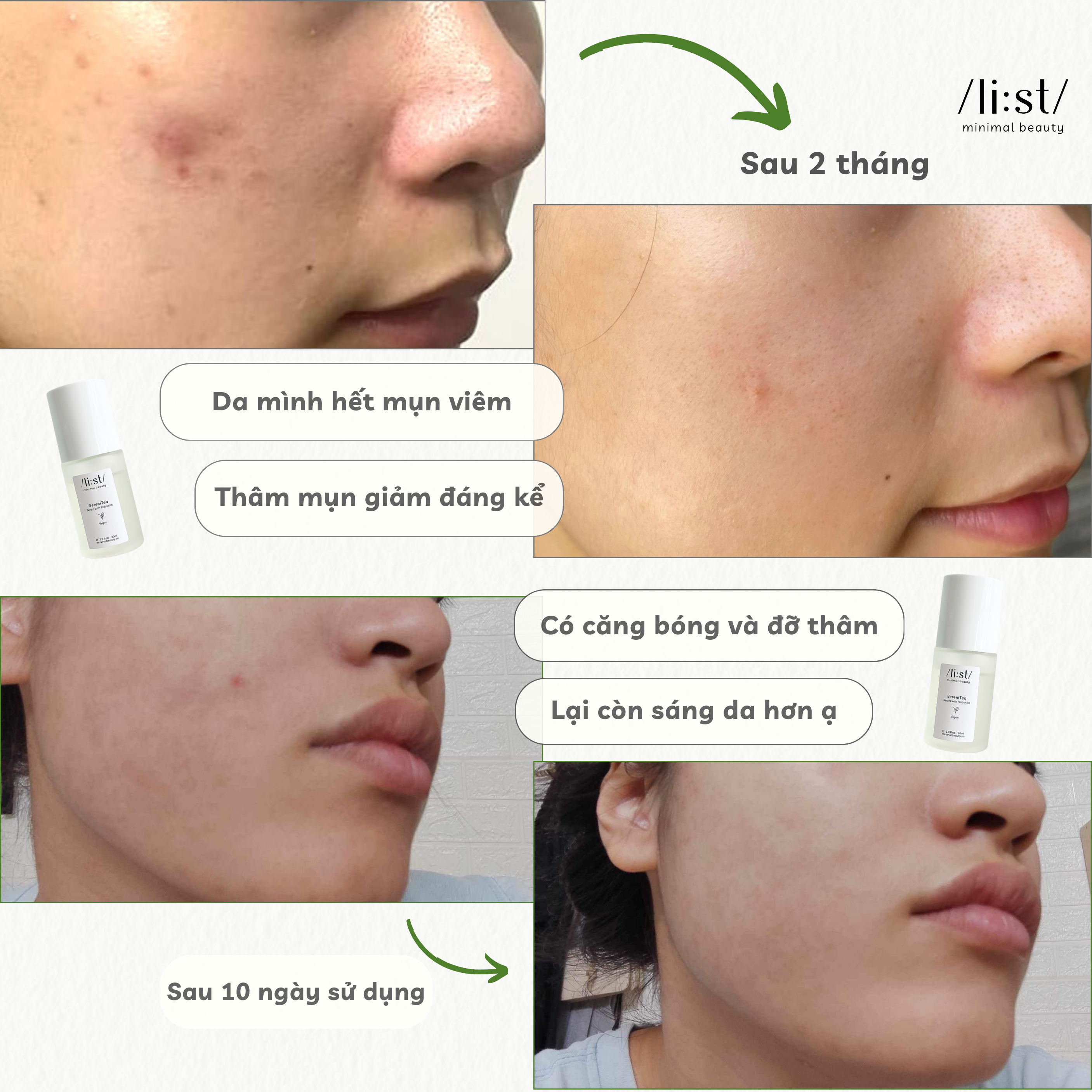 Serum Cân Bằng Vi Sinh Li:st Phục Hồi, Cấp Ẩm, Làm Trắng Sáng Da Và Chống Ánh Sáng Xanh SereniTea 30ml_thumbnail_4