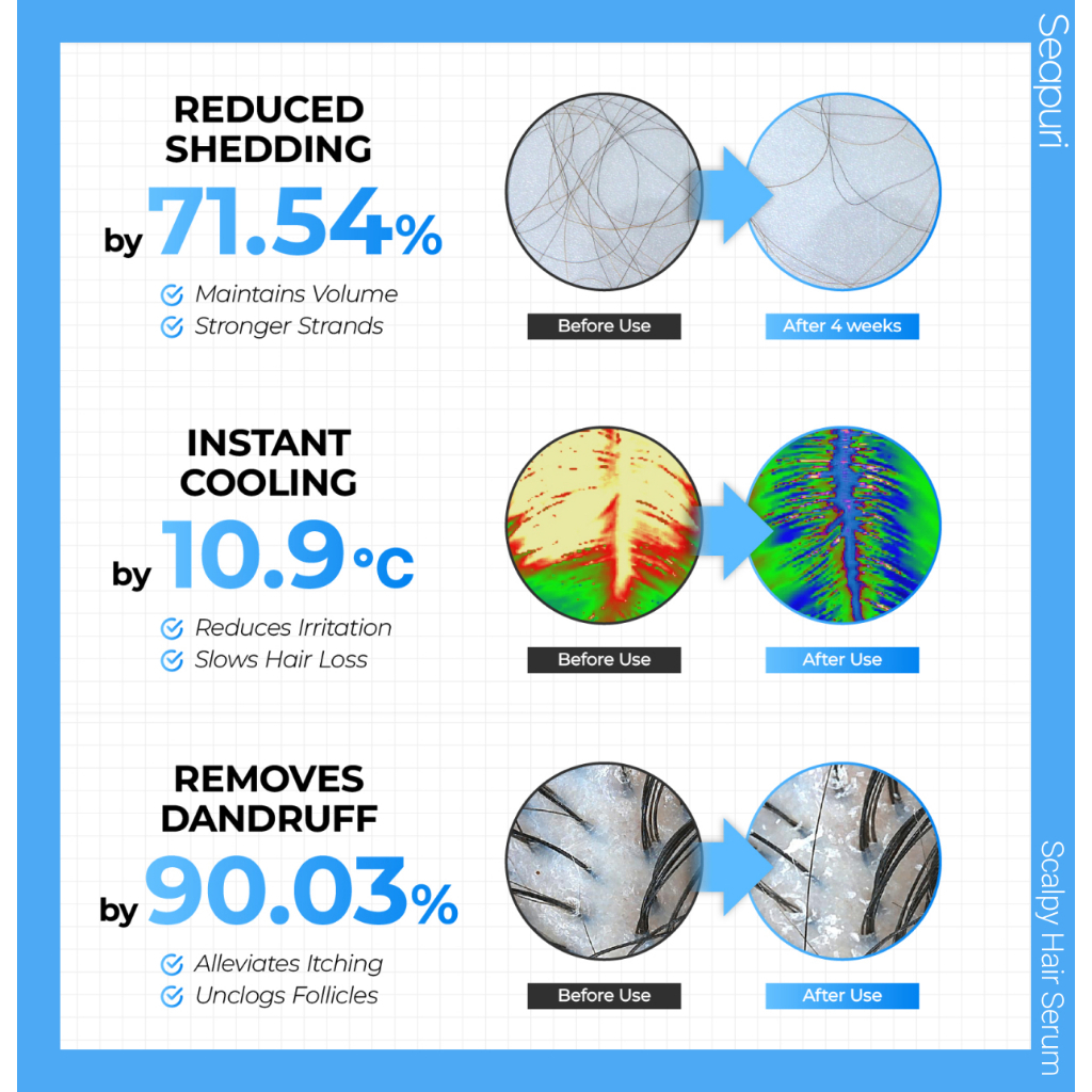 Seapuri Scalpy Hair Serum_thumbnail_8