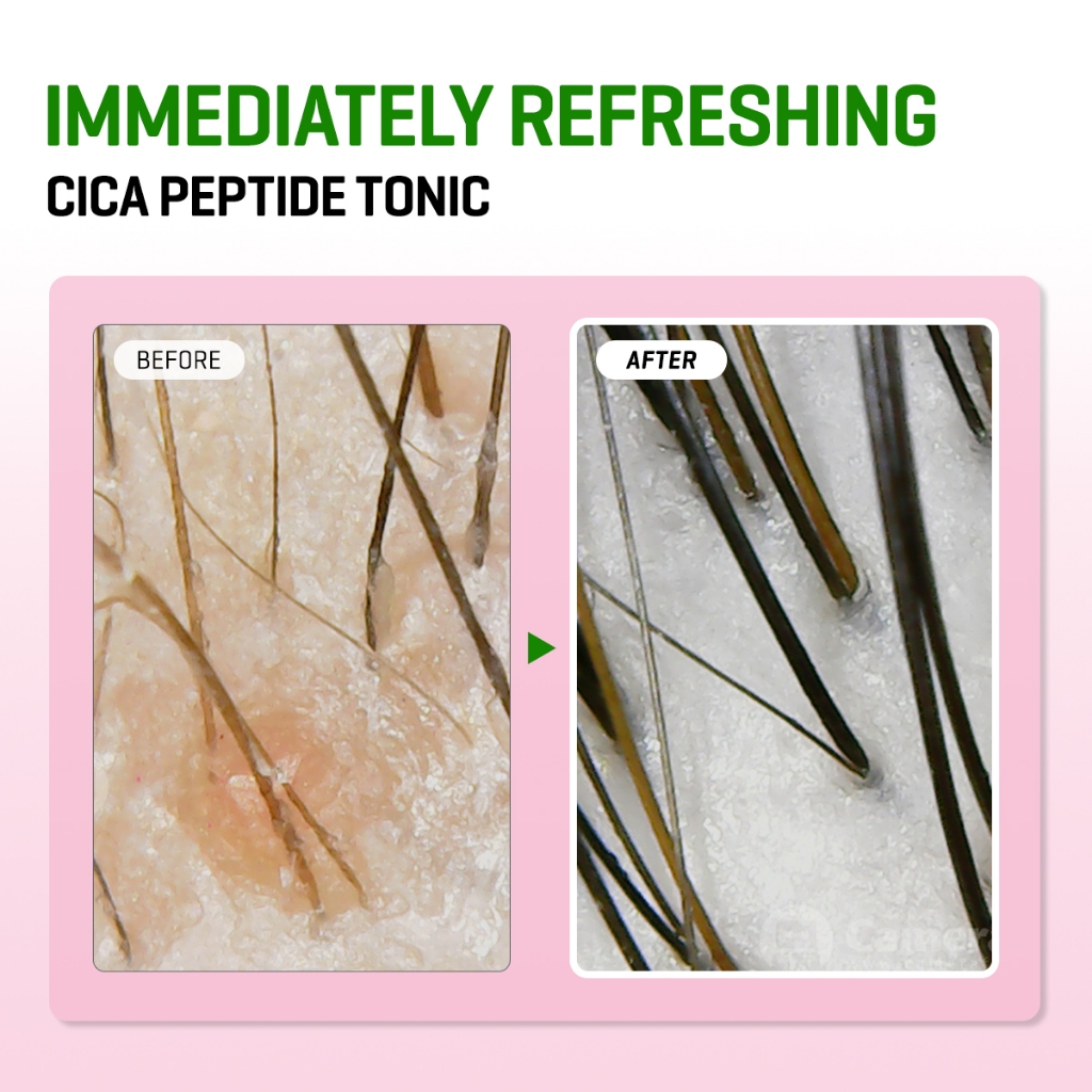 Some By Mi CICA PEPTIDE Anti Hair Loss Derma Scalp Tonic 150ml_thumbnail_4