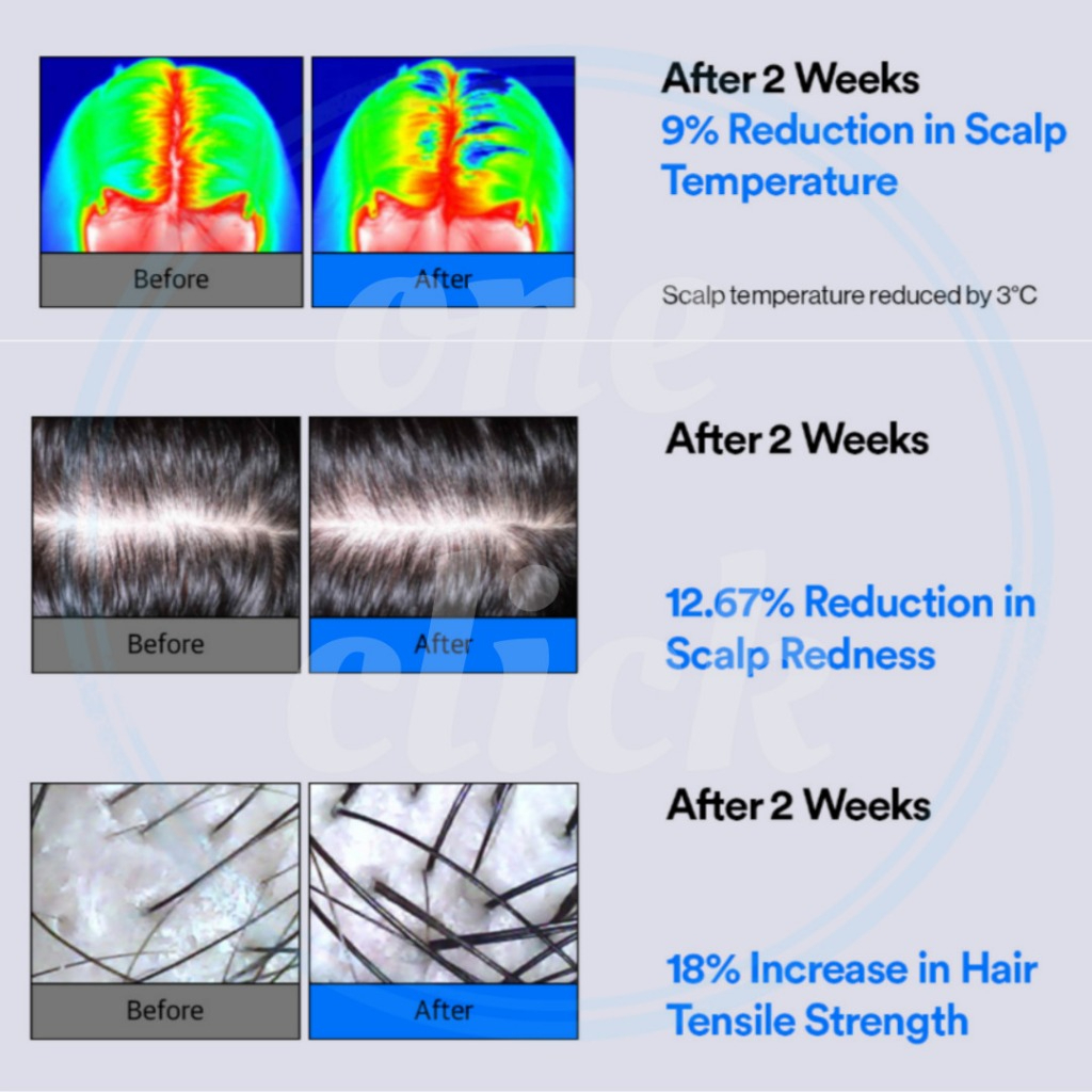 Refilled Hair Recovery 100ml_thumbnail_2