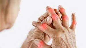 Gai xương – Nguyên nhân gây đau nhức và hạn chế vận động