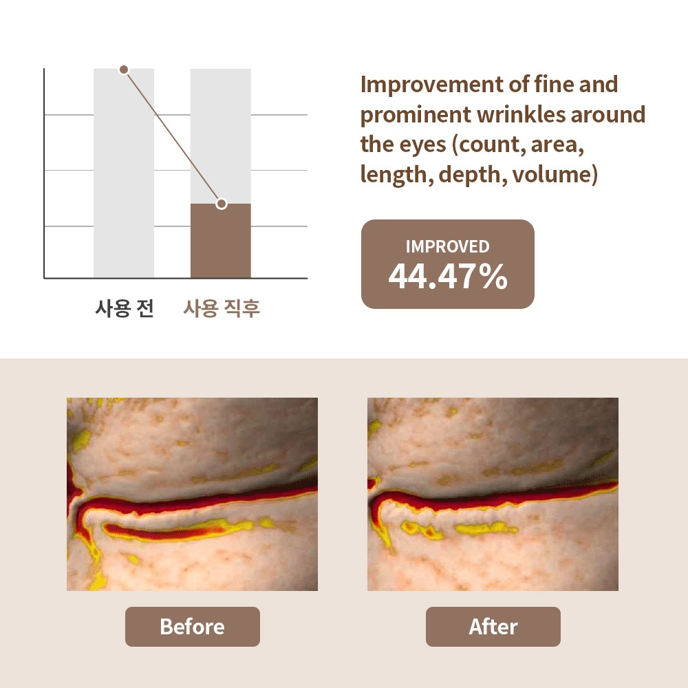 MEDIHEAL Retinol Collagen Eye Ampoule Patch_thumbnail_6