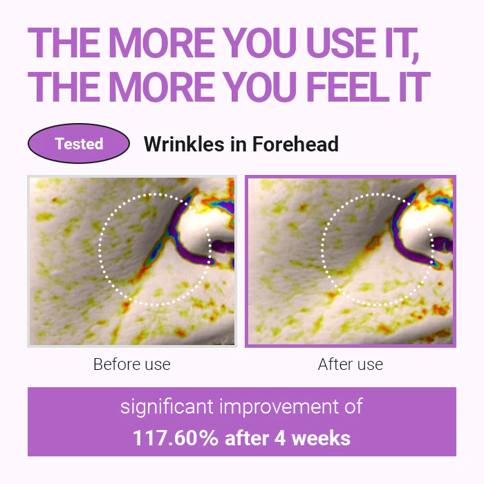 Isntree Hyper Retinol Ex 1.0 Serum 20ml_thumbnail_6