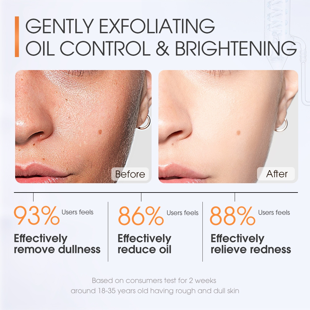 SKINEVER Salicylic Acid Refreshing Scrub Cleanser 75ml_thumbnail_4