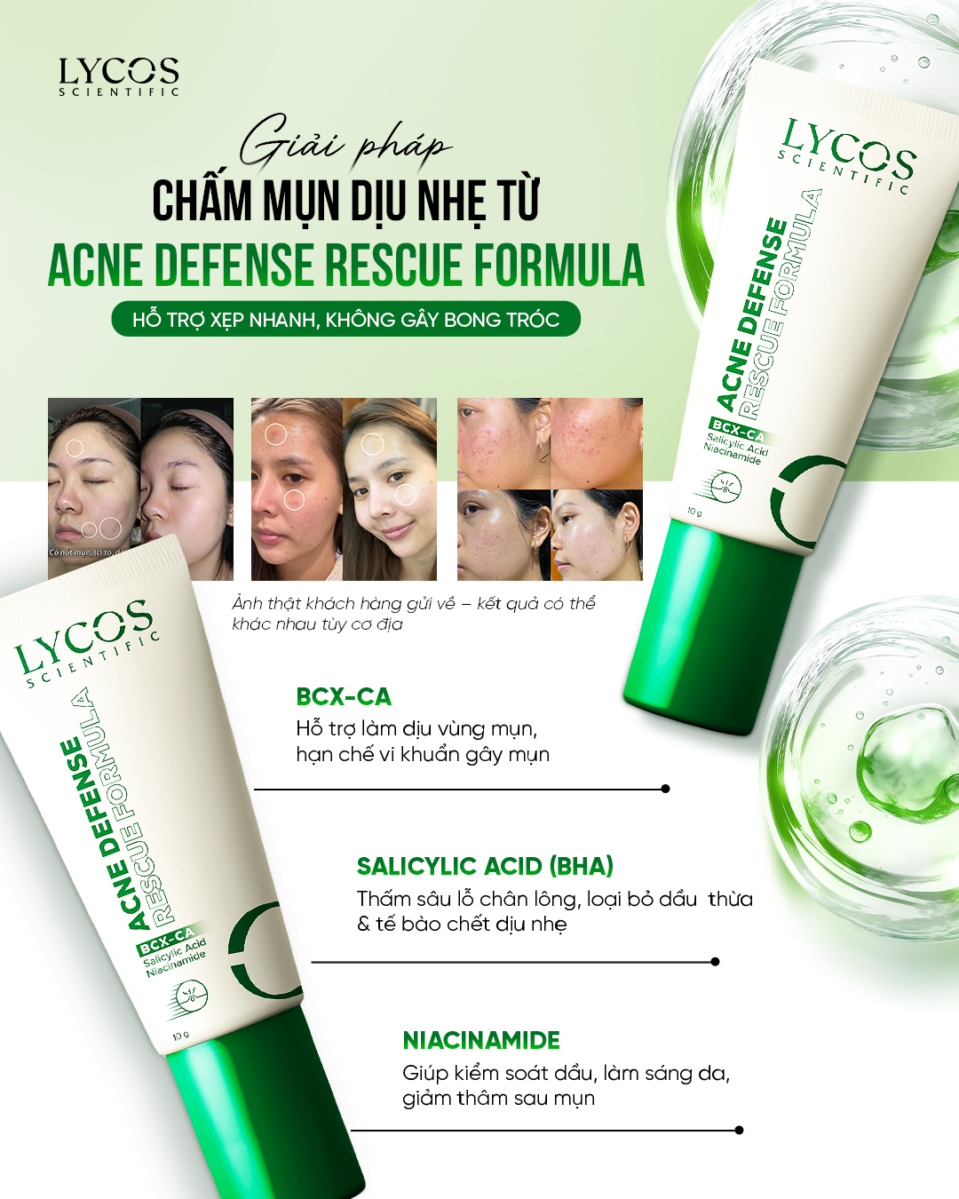 Kem Chấm Mụn LYCOS Acne Defense Rescue Formula Hỗ Trợ Làm Khô Cồi, Làm Dịu Và Chăm Sóc Vùng Da Mụn10g_thumbnail_7