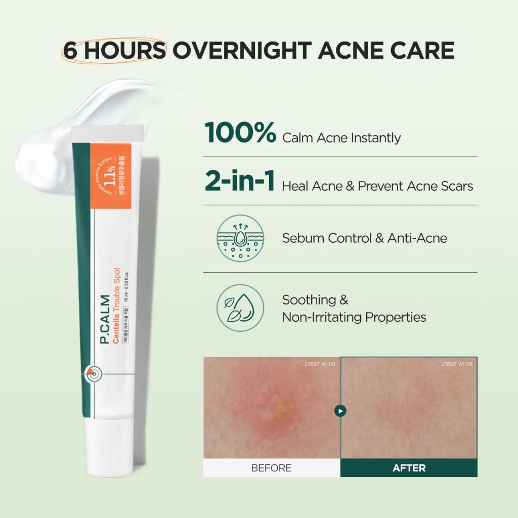 P.Calm Centella Trouble Spot 15ml_thumbnail_8