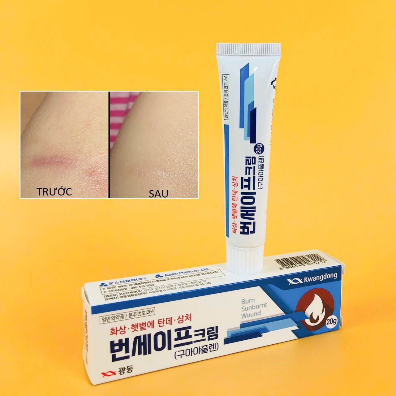 KEM BOI DIEU TRI BONG KWANGDONG_thumbnail_3