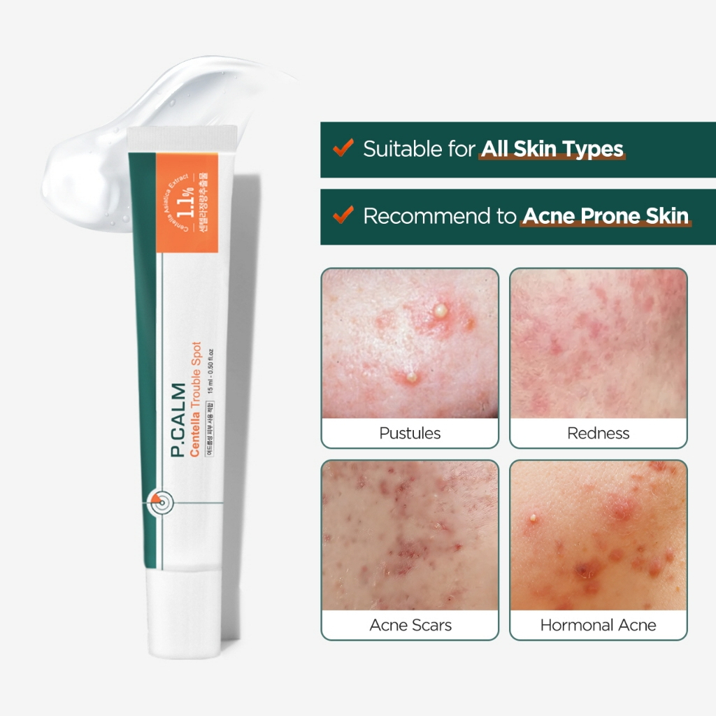 P.Calm Centella Trouble Spot 15ml_thumbnail_6
