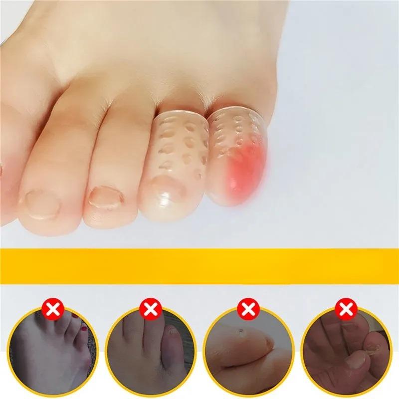 Bọc Bảo Vệ Ngón Chân_thumbnail_3