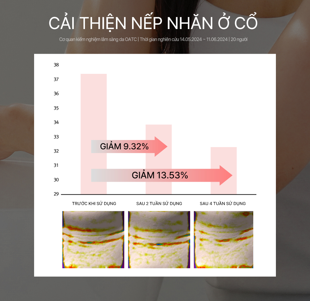 Tinh chất phục hồi da PDRN 14Days Turnover Ampoule 14 lọ/hộp_thumbnail_6