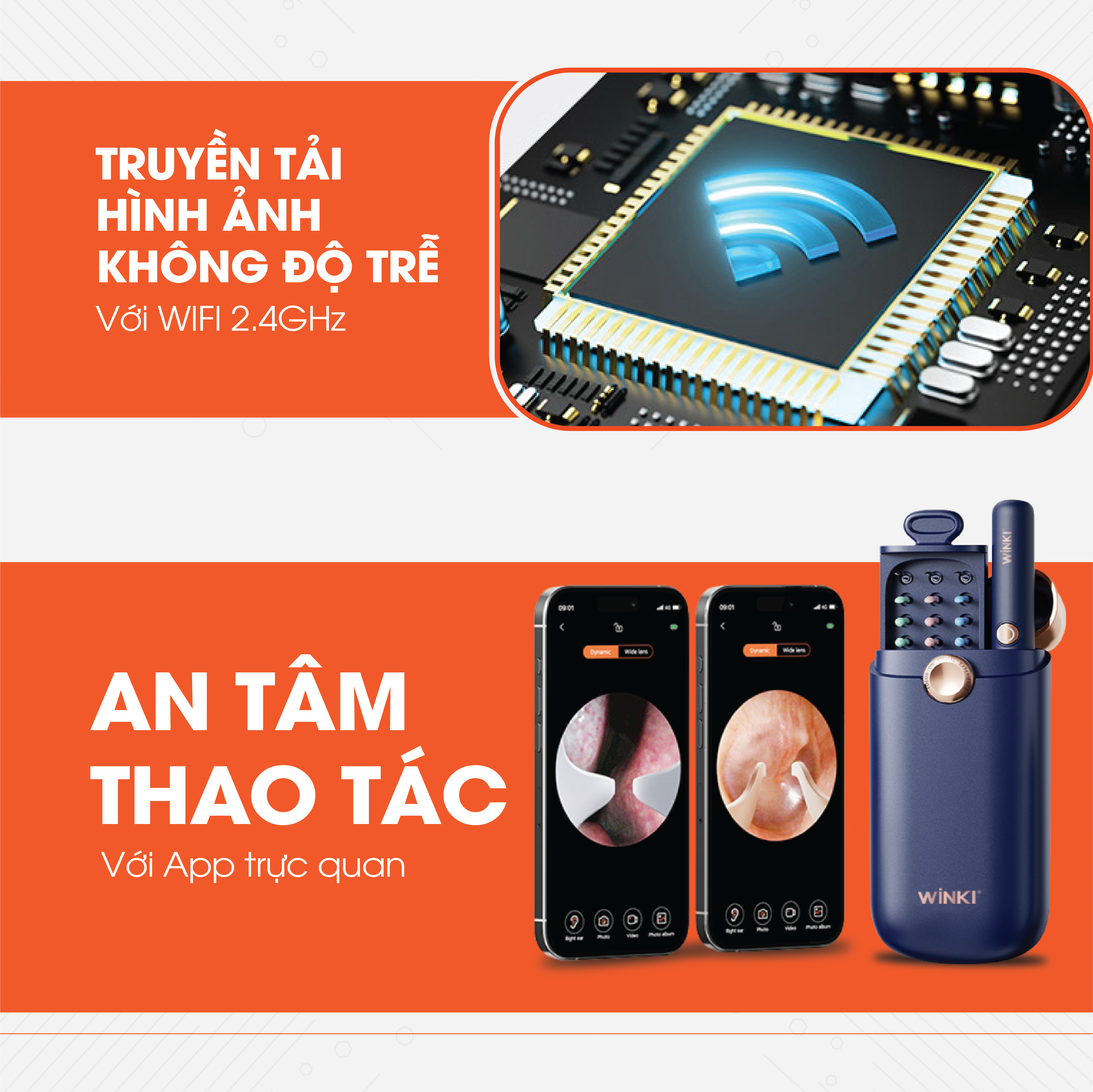 MÁY LẤY RÁY TAI CAMERA QUAN SÁT 360 ĐỘ WINKI F1PRO_thumbnail_3