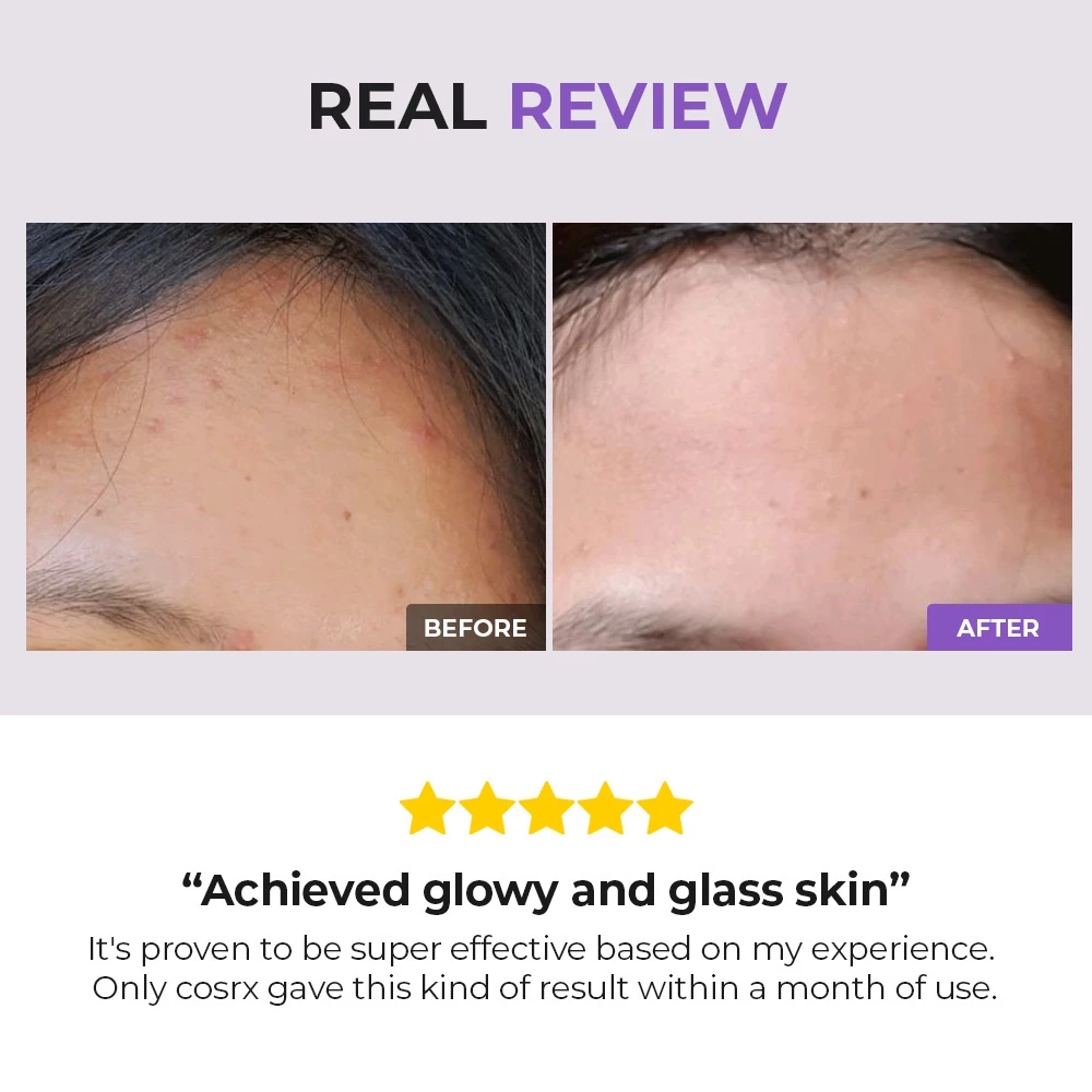 Cosrx AHA/BHA Clarifying Treatment Toner_thumbnail_7